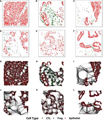 CGAT: Cell Graph ATtention Network for Grading of Pancreatic Disease Histology Images